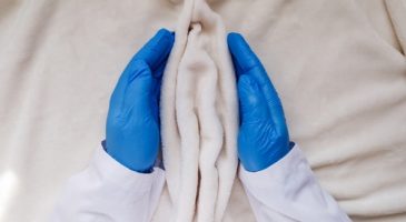 Conseil sexe : Mes lèvres pendent, puis-je me faire opérer et est-ce dangereux ?