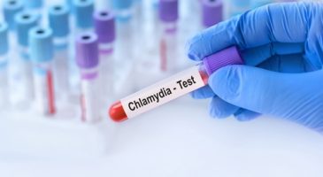 Conseil sexe : Quels sont les symptômes des infections à chlamydiae ?